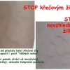 Křečové žíly - už nebolí!!!